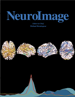 NeuroImage Cover